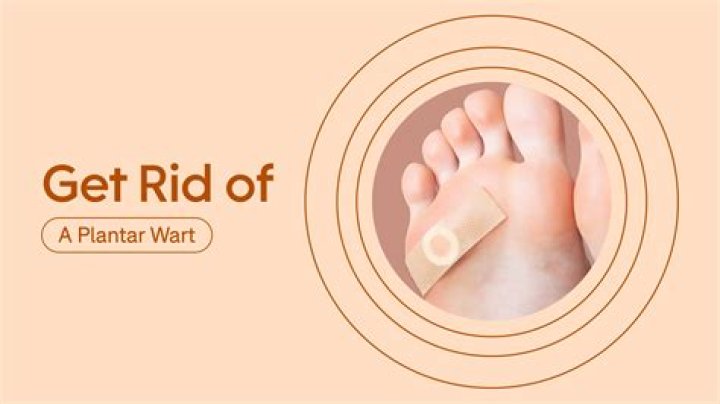 How do you get rid of a plantar wart on finger?