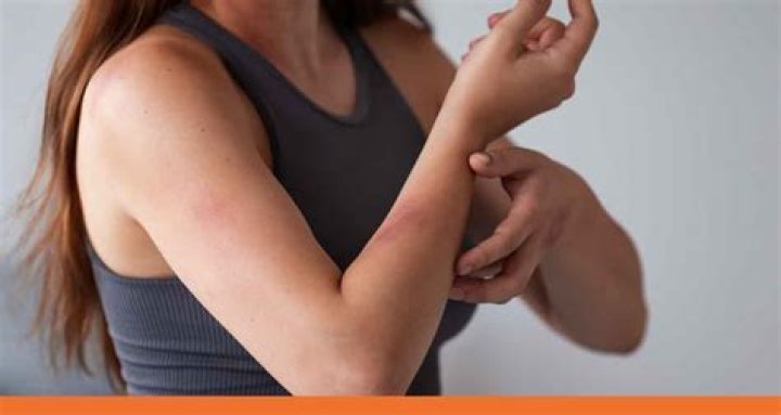 How long does centipede bite pain last?