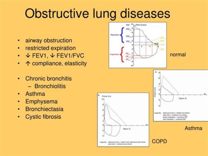 Is COPD restrictive or obstructive?